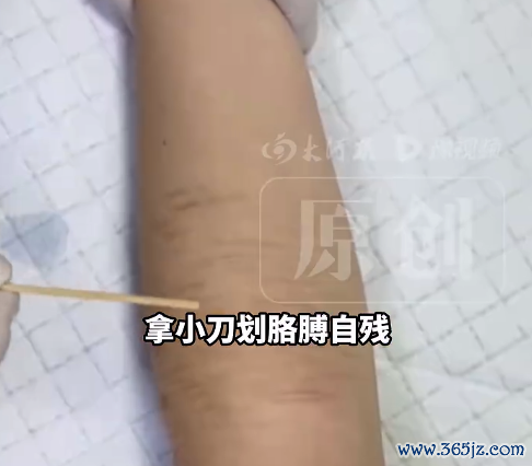 高三女生高考前表白被拒自残住院 医师判断：是失恋导致的厚谊波动和自我怀疑